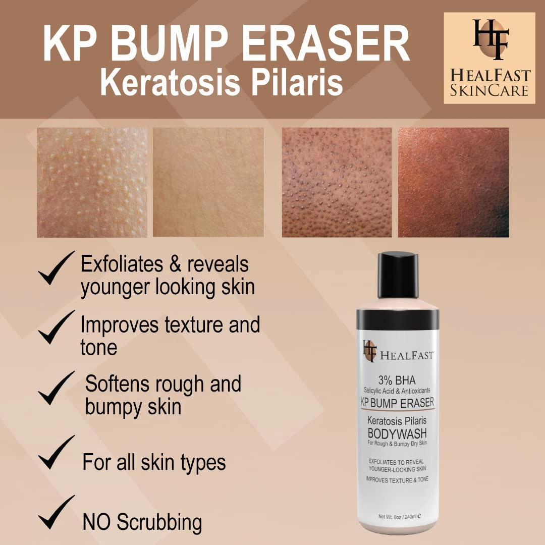 KP Bump Eraser Cream (4 Oz) and Bodywash (8 Oz) Set – Soften, Exfoliate, Nourish Rough and Bumpy Skin – Keratosis Pilaris - For All Types